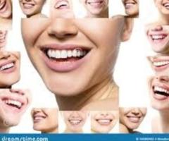 Teeth cleaning services dentista facil - Puebla